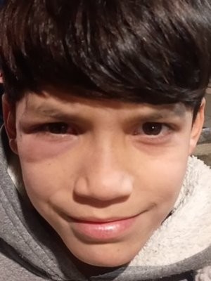 Foto